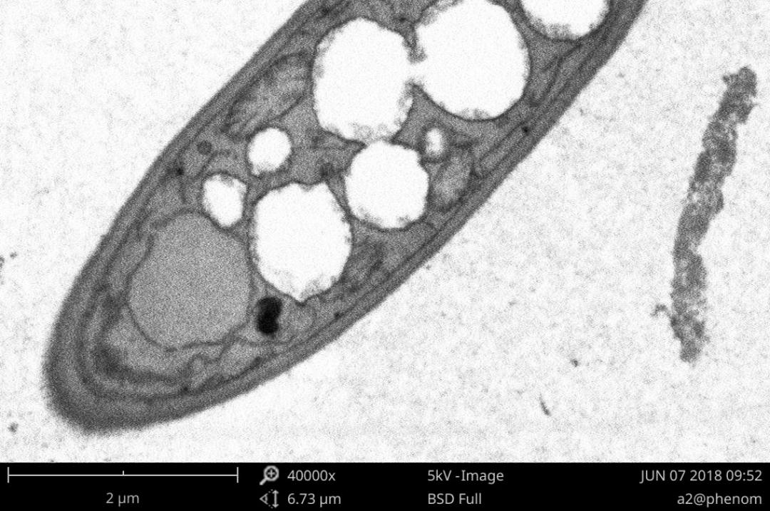 Bacterial Tissue Section