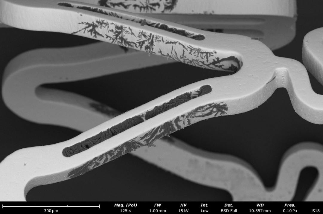 Stent