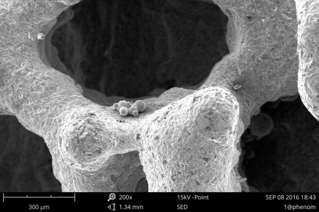 3D-printed Hip Joints