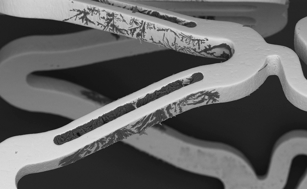 Stents