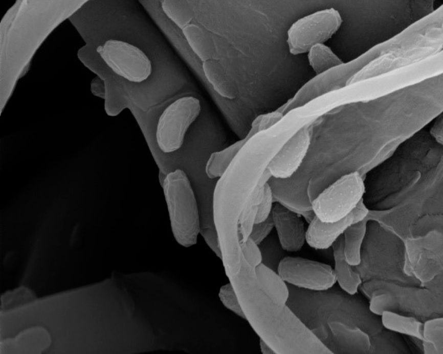 疫情肆虐，纳米抗菌材料的春天来了？