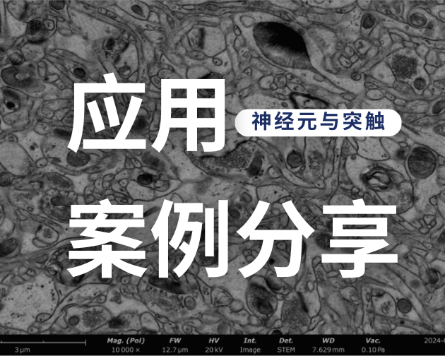 扫描电镜助力神经元与突触研究｜飞纳 Pharos STEM 生物电镜案例分享