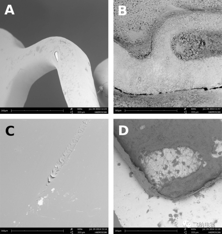不同材质心脏支架体外血液模拟实验后扫描电镜图