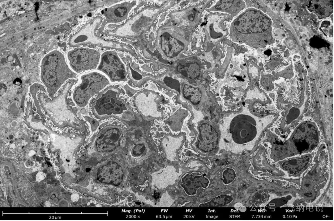 台式场发射生物电镜观察系膜细胞