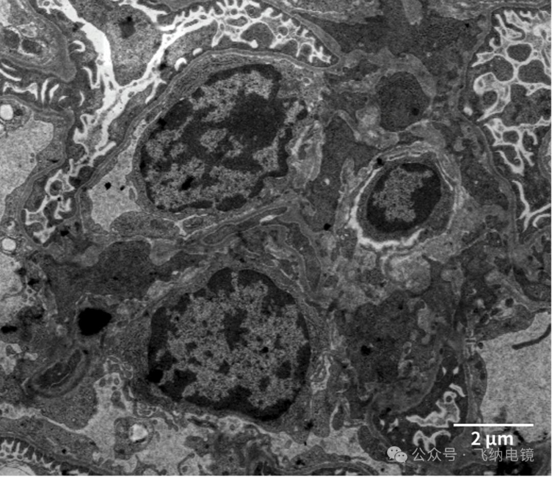 台式场发射生物电镜下的系膜细胞
