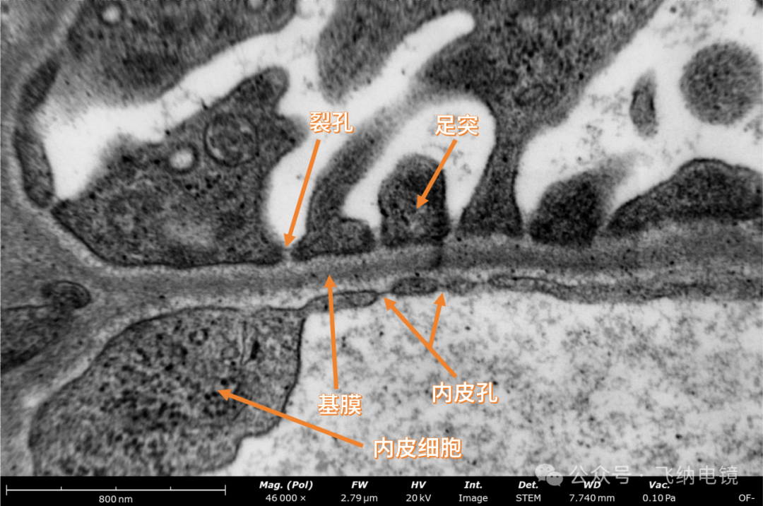台式场发射生物电镜下的内皮细胞