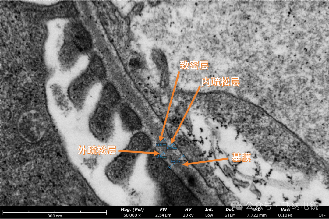 场发射生物电镜观察肾小球基膜