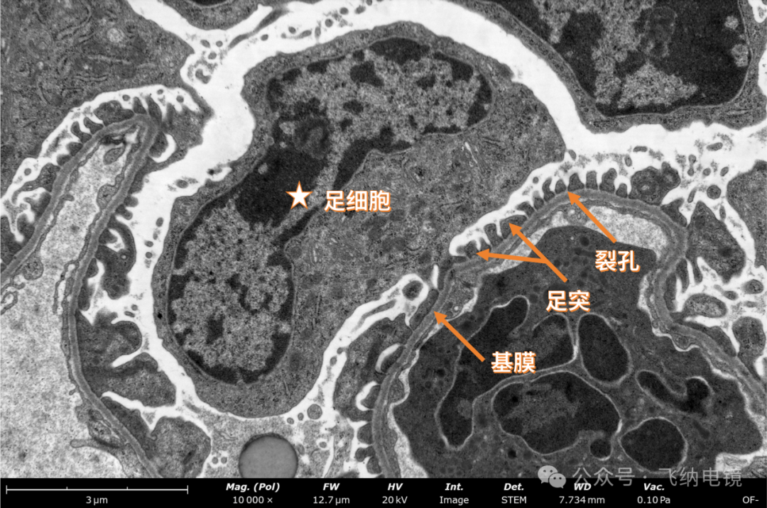 扫描电镜观察足细胞