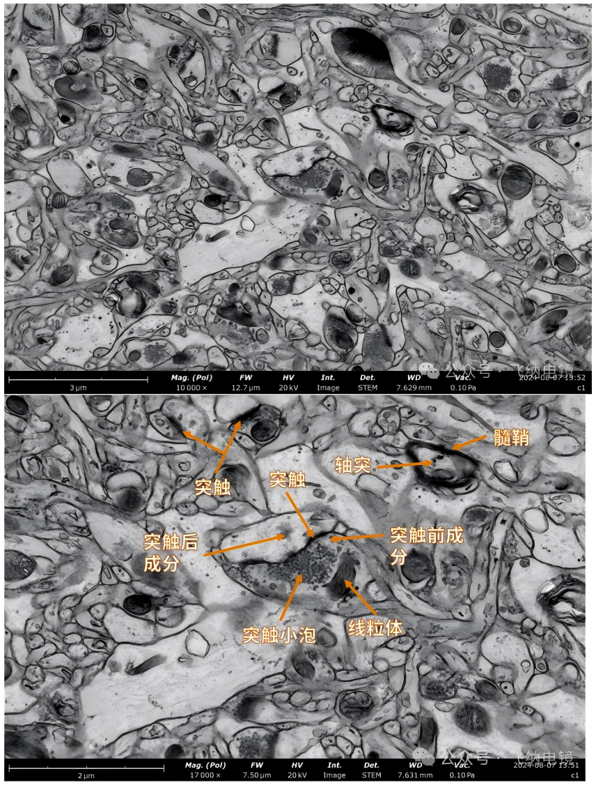 掃描電鏡下化學(xué)性突觸